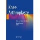 Knee Arthroplasty: New and Future Directions