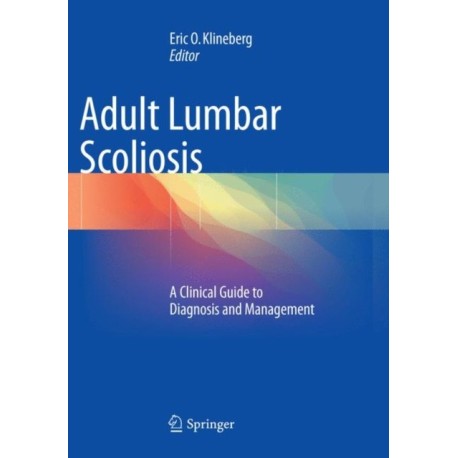 Adult Lumbar Scoliosis: A Clinical Guide to Diagnosis and Management