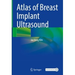 Atlas of Breast Implant Ultrasound