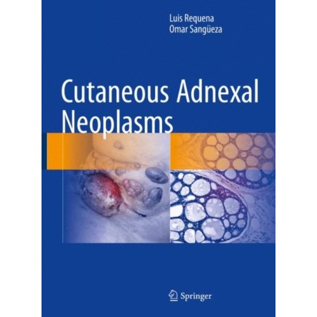 Cutaneous Adnexal Neoplasms
