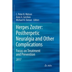Herpes Zoster: Postherpetic Neuralgia and Other Complications: Focus on Treatment and Prevention