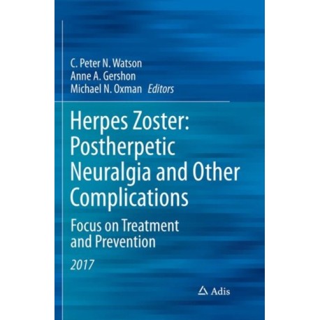 Herpes Zoster: Postherpetic Neuralgia and Other Complications: Focus on Treatment and Prevention