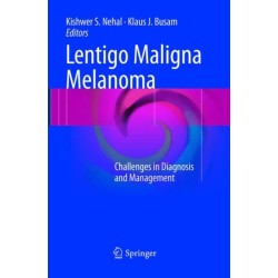 Lentigo Maligna Melanoma: Challenges in Diagnosis and Management
