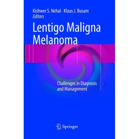 Lentigo Maligna Melanoma: Challenges in Diagnosis and Management