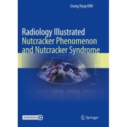 Radiology Illustrated: Nutcracker Phenomenon and Nutcracker Syndrome