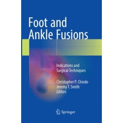 Foot and Ankle Fusions: Indications and Surgical Techniques