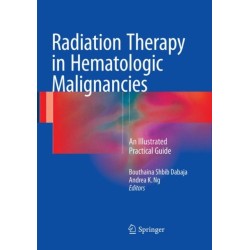 Radiation Therapy in Hematologic Malignancies: An Illustrated Practical Guide