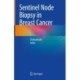Sentinel Node Biopsy in Breast Cancer