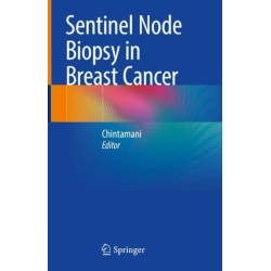 Sentinel Node Biopsy in Breast Cancer