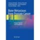 Bone Metastases from Prostate Cancer: Biology, Diagnosis and Management