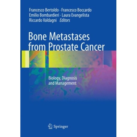 Bone Metastases from Prostate Cancer: Biology, Diagnosis and Management