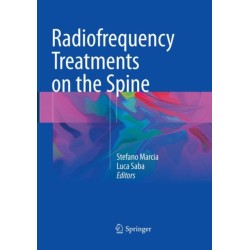 Radiofrequency Treatments on the Spine