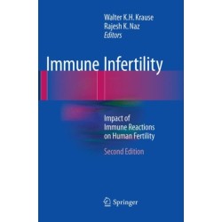 Immune Infertility: Impact of Immune Reactions on Human Fertility