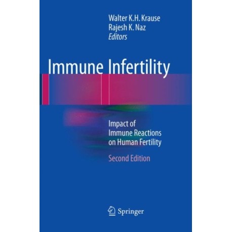 Immune Infertility: Impact of Immune Reactions on Human Fertility