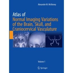 Atlas of Normal Imaging Variations of the Brain, Skull, and Craniocervical Vasculature