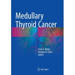 Medullary Thyroid Cancer