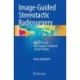 Image-Guided Stereotactic Radiosurgery: High-Precision, Non-invasive Treatment of Solid Tumors