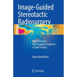 Image-Guided Stereotactic Radiosurgery: High-Precision, Non-invasive Treatment of Solid Tumors