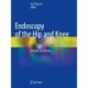 Endoscopy of the Hip and Knee: Principle and Practice