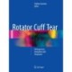 Rotator Cuff Tear: Pathogenesis, Evaluation and Treatment