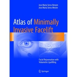 Atlas of Minimally Invasive Facelift: Facial Rejuvenation with Volumetric Lipofilling