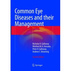 Common Eye Diseases and their Management