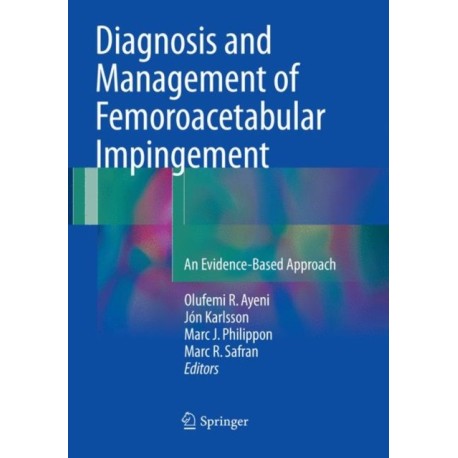 Diagnosis and Management of Femoroacetabular Impingement: An Evidence-Based Approach