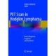 PET Scan in Hodgkin Lymphoma: Role in Diagnosis, Prognosis, and Treatment