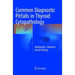 Common Diagnostic Pitfalls in Thyroid Cytopathology