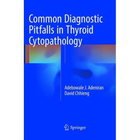 Common Diagnostic Pitfalls in Thyroid Cytopathology