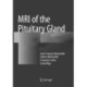 MRI of the Pituitary Gland