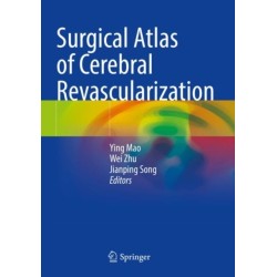 Surgical Atlas of Cerebral Revascularization
