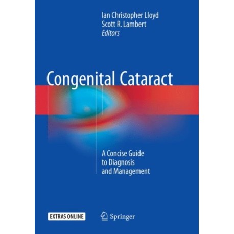 Congenital Cataract: A Concise Guide to Diagnosis and Management