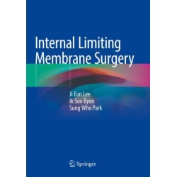 Internal Limiting Membrane Surgery