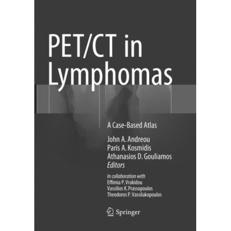 PET/CT in Lymphomas: A Case-Based Atlas