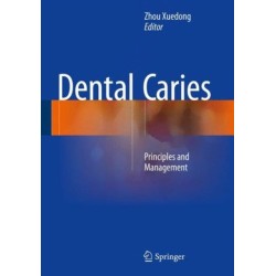 Dental Caries: Principles and Management