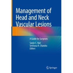 Management of Head and Neck Vascular Lesions: A Guide for Surgeons