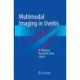 Multimodal Imaging in Uveitis