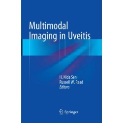 Multimodal Imaging in Uveitis