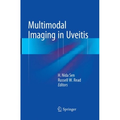 Multimodal Imaging in Uveitis