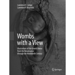 Wombs with a View: Illustrations of the Gravid Uterus from the Renaissance through the Nineteenth Century