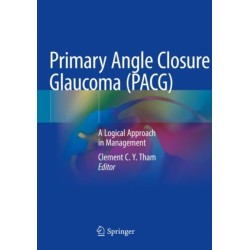 Primary Angle Closure Glaucoma (PACG): A Logical Approach in Management