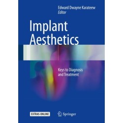 Implant Aesthetics: Keys to Diagnosis and Treatment