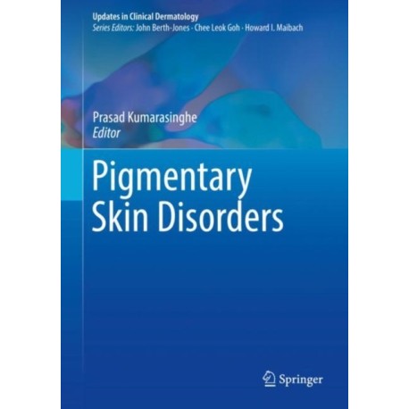 Pigmentary Skin Disorders