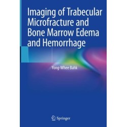 Imaging of Trabecular Microfracture and Bone Marrow Edema and Hemorrhage