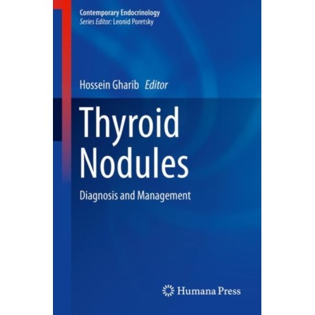 Thyroid Nodules: Diagnosis and Management
