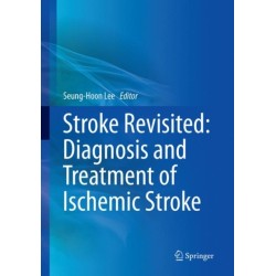 Stroke Revisited: Diagnosis and Treatment of Ischemic Stroke