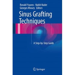 Sinus Grafting Techniques: A Step-by-Step Guide
