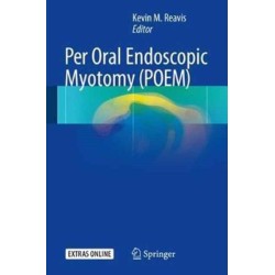 Per Oral Endoscopic Myotomy (POEM)