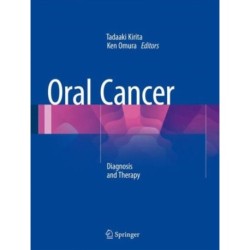 Oral Cancer: Diagnosis and Therapy